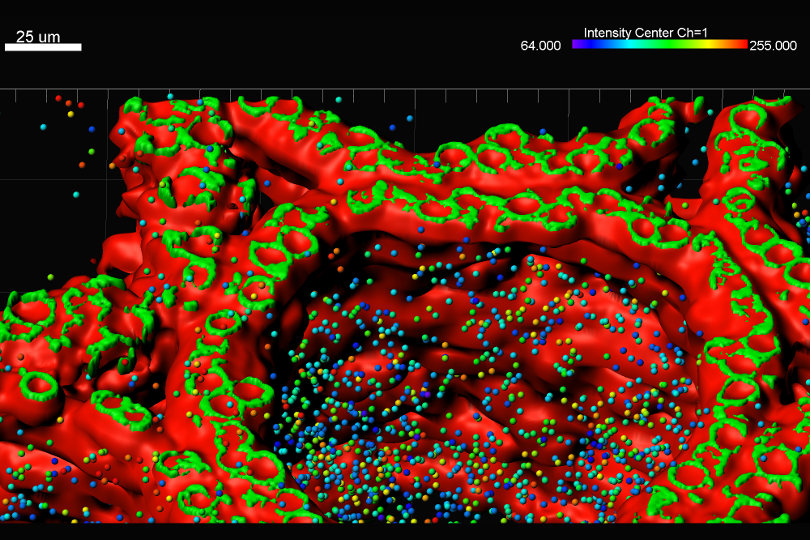 Imaris Bitplane 3D imaging example
